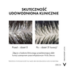 Vichy Dercos DS 2w1 Szampon przeciwłupieżowy z odżywką