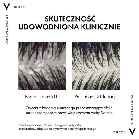 Vichy Dercos Anti Dandruff DS, szampon przeciwłupieżowy, włosy normalne i przetłuszczające się, 200 ml