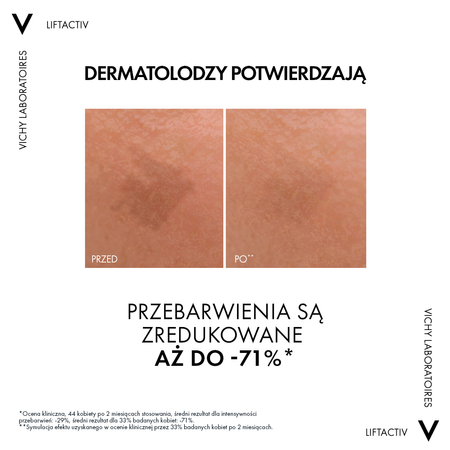Vichy Liftactiv Specialist B3 Serum redukujące przebarwienia i zmarszczki z 5% niacynamidu, 30 ml